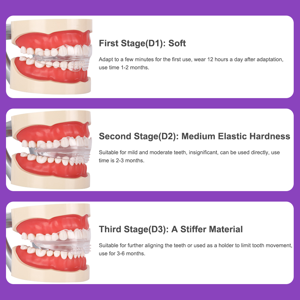 Dental Orthotics Teeth Whitening Tool Tooth Orthodontics Dental Braces Orthodontic Retainers Tooth Alignment Trainer Oral Care